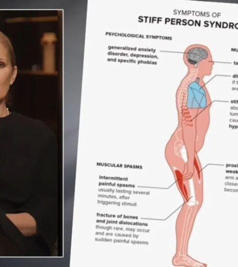 Explore the complexities of Stiff Person Syndrome, a rare neurological disorder causing muscle stiffness and spasms. Gain insights into its symptoms, underlying causes, and available treatment options. Stay informed with Musical States.